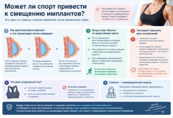 Спорт и смещение имплантов